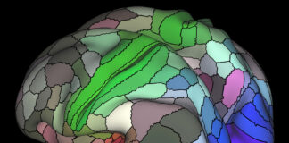 New Study Raises Doubts About fMRI Neuroimaging Research