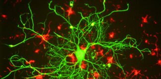 The Failed Quest for Biomarkers in Psychiatry