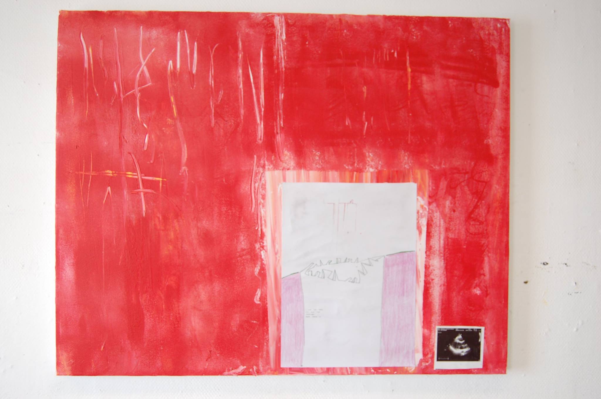 Red background with white markings in top left corner, a white square and ultrasound photo in bottom right