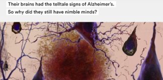 “Their Brains had the Telltale Signs of Alzheimer’s. So why did They Still Have Nimble Minds?”