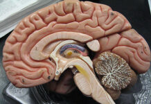 Traumatic Brain Injury Associated with Incarceration