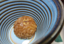 Brain Scans Cannot Differentiate Between Mental Health Conditions