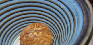 Brain Scans Cannot Differentiate Between Mental Health Conditions