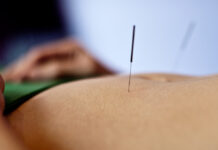 New Data Supports Acupuncture as a Treatment for Depression