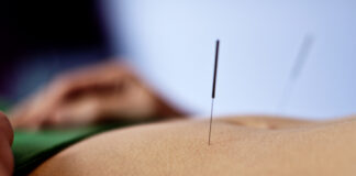 New Data Supports Acupuncture as a Treatment for Depression