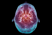 Why Upgrading Your Brain Could Make you Less Human