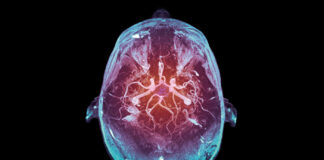Why Upgrading Your Brain Could Make you Less Human