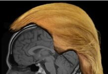 Don’t Blame Trump’s Brain