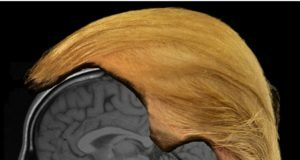 Don’t Blame Trump’s Brain