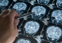 More Experience Hallucinations Than Previously Thought
