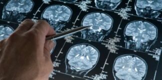 More Experience Hallucinations Than Previously Thought
