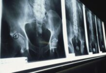 The Long History of Discrimination in Pain Medicine