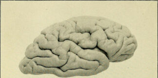 Researchers Fail to Predict Criminal Intent with Brain Scans