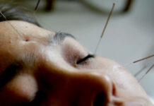 FDA Proposes That Doctors Learn About Acupuncture