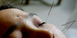FDA Proposes That Doctors Learn About Acupuncture