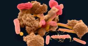 A Shot Against Post-Traumatic Stress Disorder