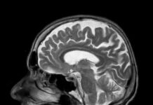 Unreliability of fMRI Emotional Biomarkers