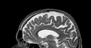 Unreliability of fMRI Emotional Biomarkers