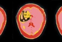 Power Causes Brain Damage