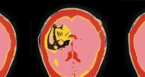 Power Causes Brain Damage
