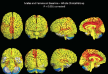 Female Brains are More Active?