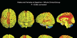 Female Brains are More Active?