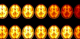 The Man With the Most Famous Brain in Science