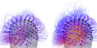 Implant ‘Restores Consciousness’ to Man in Vegetative State