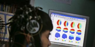 How a Focus on Rich Educated People Skews Brain Studies