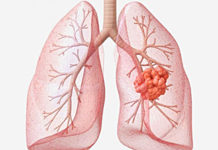 Why Disease and Illness Are Concepts of the Body disease
