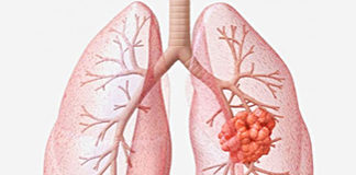 Why Disease and Illness Are Concepts of the Body disease