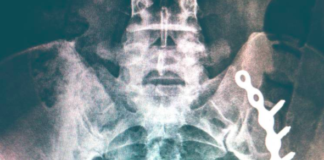 Licensed to Bill: How Doctors Profit From Injury Assessments