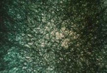 Histories of Violence: Neurodiversity and the Policing of the Norm