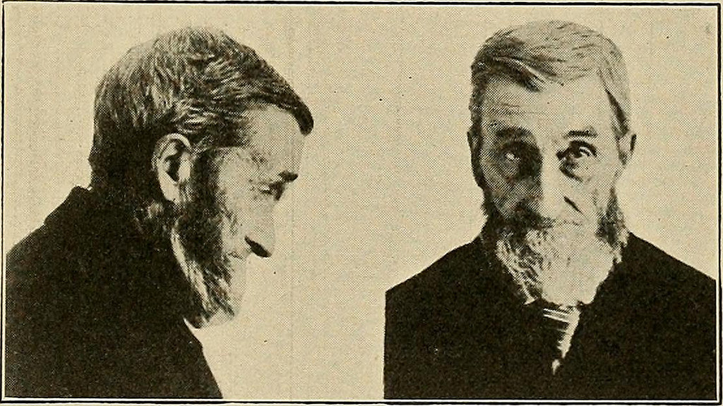 New Article Details Criticism of Psychiatric Diagnosis Through History