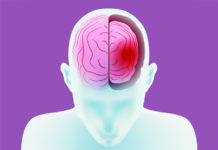 Institutionalization: An Unacknowledged Cause of Psychiatric Outpatients’ Deterioration brain atrophy