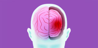 Institutionalization: An Unacknowledged Cause of Psychiatric Outpatients’ Deterioration brain atrophy