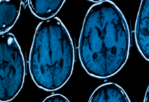 Barbara Ehrenreich: Why I’m Giving Up on Preventative Care