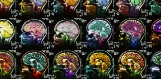 Depression: The Radical Theory Linking it to Inflammation