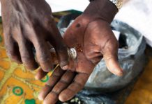 Integrating Indigenous Healing Practices and Psychotherapy for Global Mental Health