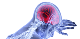 New Study Finds Limited Effectiveness for Antidepressants After Stroke