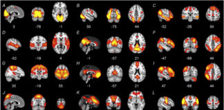 No Brain Connectivity Differences Between Autism, ADHD, and “Typical Development”