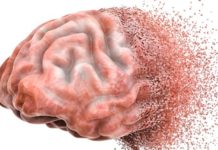 Anticholinergic Psychiatric Drugs Linked to a 50% Increase in Dementia