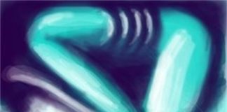 How Pain is Treated Depends on Socioeconomic Status