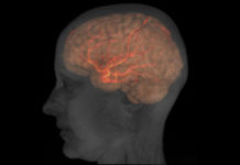 The Lure of ‘Cool’ Brain Research Is Stifling Psychotherapy