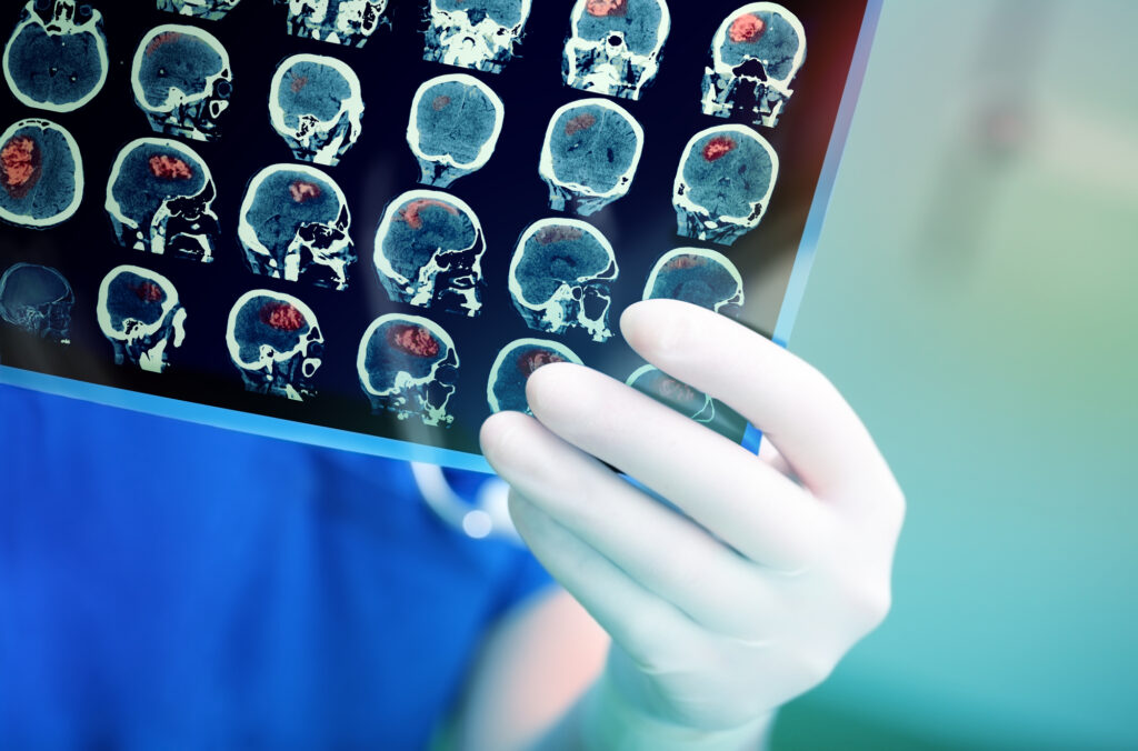 Doctor attentively examines the MRI scan of the patient.