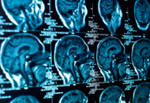 Nature: Brain Imaging Studies Are Most Likely False