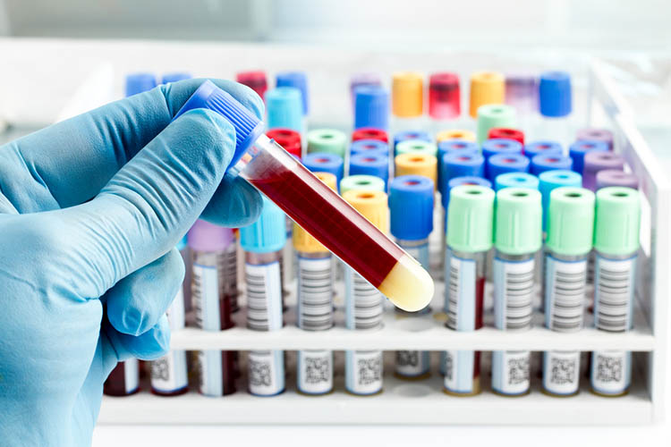 Stock photo of a hand of a lab technician holding blood tube test