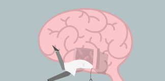 Response to Criticism of Our Serotonin Paper An illustration of a doctor falling headfirst into a door in a giant brain, his feet kicking outside