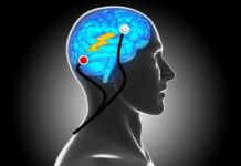 Transcranial Direct Current Stimulation (tDCS) Fails to Treat Depression