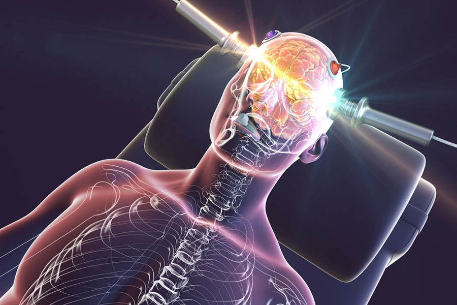 3D illustration of anatomic figure lying down with electric shock through its brain